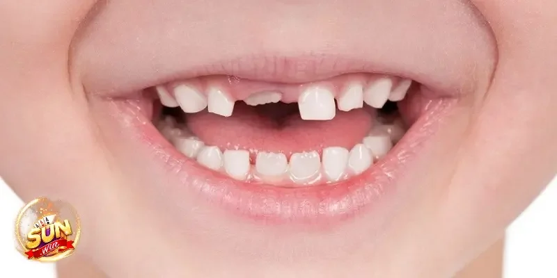 Kinh nghiệm chọn số từ giấc mơ rụng răng