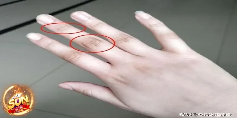 Mơ thấy ngón tay có thể hé lộ điều gì về vận may và cơ hội chiến thắng