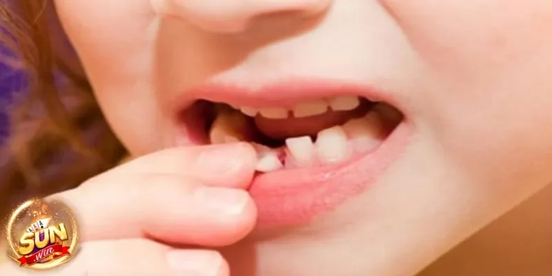 Mơ thấy rụng răng có liên quan gì đến chuyện đổi vận hay may rủi