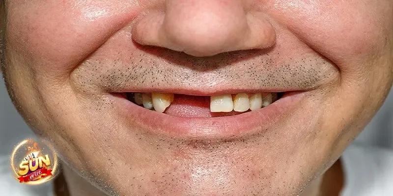 Nằm mơ rụng răng đánh con gì theo ngữ cảnh khác